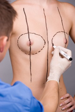 Choosing The Best Plastic Surgeon For Your Breast Lift Surgery With Implants 
